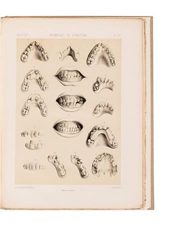 MEDICINE  (DENTISTRY.)  Magitot, Émile. Traité des Anomalies du Système Dentaire chez lHomme et les Mammifères.  1877